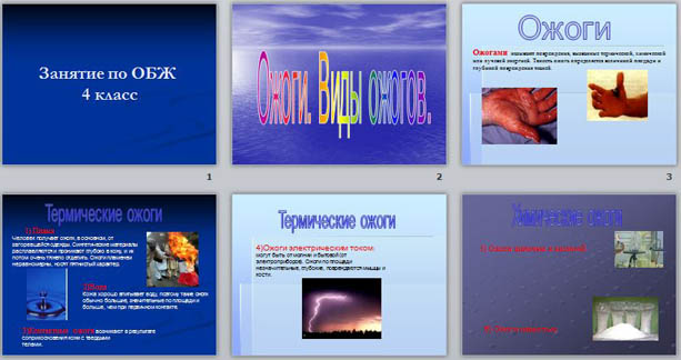 Презентация к уроку ОБЖ для начальных классов Ожоги. Виды ожогов