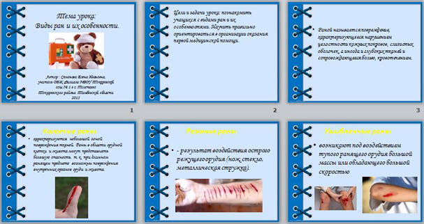 Презентация к уроку ОБЖ Виды ран и их особенности